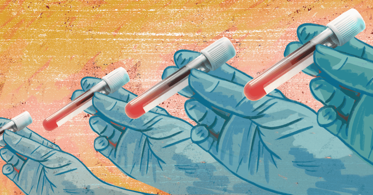How PSA Testing Saved Me Again and Again With Prostate Cancer
