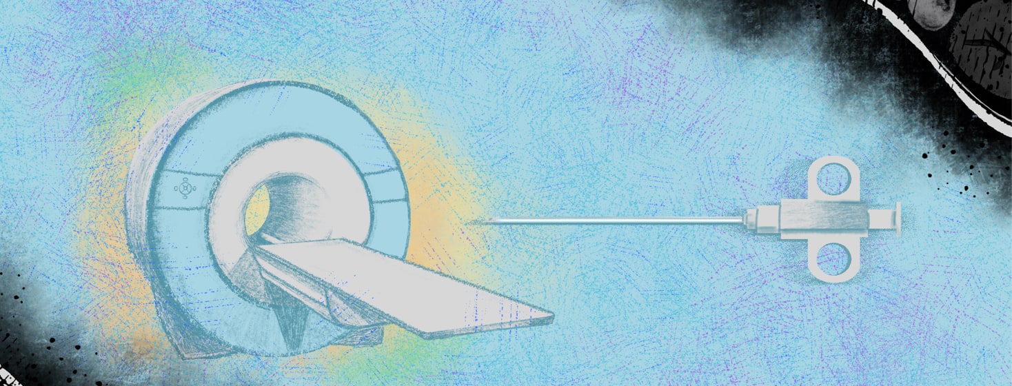 My Prostate Biopsy: A Step-by-Step Guide to What the Procedure Can Really be Like image