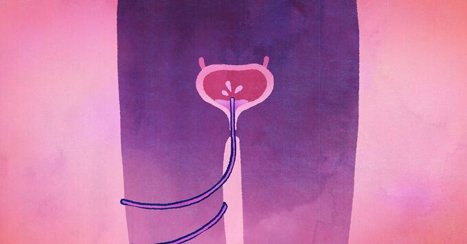 Me and My Catheter image
